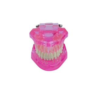 Modèle pédagogique en plastique pour la démonstration des pathologies dentaires : caries, kyste apical, tartre, implant, impaction, etc. - Product Image 1