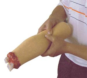 上肢創傷ケアモデル、腕切断および止血モデル - Product Image 4