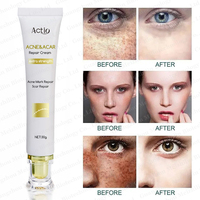 Crème Réparatrice Naturelle Visage et Corps Contre les Cicatrices – Efficacité Rapide pour Lisser et Éliminer les Marques de Grossesse, Vergetures, Boutons et Cicatrices d'Acné