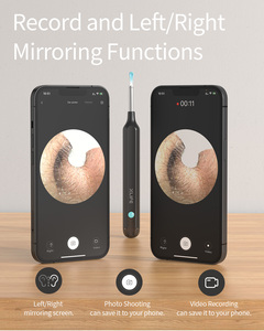 Bebird Smart Ear Wax <span class=keywords><strong>Tige</strong></span> de nettoyage Wifi Connexion avec Mobiles APP Smart Electronics Visual Ear Cleaner - Product Image 2