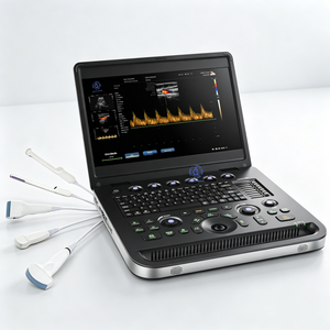 Échographe <span class=keywords><strong>Doppler</strong></span> Couleur Portable à Prix Abordable pour Gynécologie et Cardiovasculaire - Product Image 1