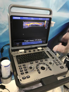 Chison Ebit50 draagbare echografiemachine Kleuren <span class=keywords><strong>Doppler</strong></span> voor OB&GYN, hartmeting met twee probes - Product Image 5