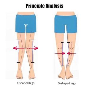 Sabuk Koreksi Tipe Kaki O/X untuk Anak, Penyangga Postur Kaki Anak, Penyangga Lutut Valgus, Sabuk Pelurus, Perban - Product Image 2