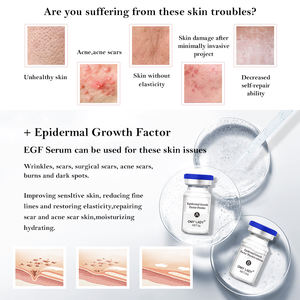 بسعر الجملة بشعار مصمم حسب الطلب خلوية خلوية نباتية للعناية بالبشرة Egf سيروم علاج حب الشباب OEM علامة خاصة - Product Image 3
