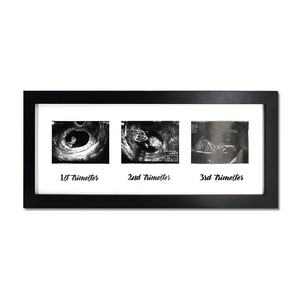 Cadre photo noir et blanc à ultrasons personnalisé pour bébé, idée cadeau de fête prénatale - Product Image 2