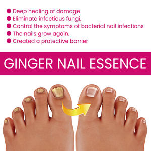 OUHOE Sérum de traitement contre les champignons des <span class=keywords><strong>ongles</strong></span> <span class=keywords><strong>à</strong></span> l'<span class=keywords><strong>huile</strong></span> d'<span class=keywords><strong>arbre</strong></span> <span class=keywords><strong>à</strong></span> <span class=keywords><strong>thé</strong></span> et au gingembre Soins des <span class=keywords><strong>ongles</strong></span> - Product Image 5