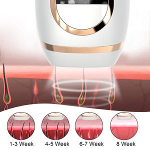 Machine indolore domestique Laser usage domestique épilateur dissolvant Permanent Portable combiné épilation lumière IPL dispositif d'épilation - Product Image 4