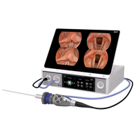 Système de stroboscopie et de laryngoscopie portable IKEDA YKD-9671S - Caméra Full HD et écran 15,6 pouces pour la chirurgie ORL
