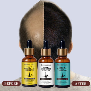 Productos para el Cuidado del Cabello en Oferta 2025, Aceite de Romero Herbal Natural para Nutrir el Cuero Cabelludo, Suero para el Crecimiento del Cabello con Aceite de Romero - Product Image 2