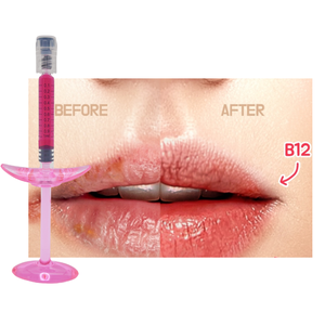 Gel <span class=keywords><strong>de</strong></span> Relleno Labial Rojo con Ácido Hialurónico Reticulado y Vitamina B12, Relleno Dérmico Natural para <span class=keywords><strong>Aumento</strong></span> <span class=keywords><strong>de</strong></span> <span class=keywords><strong>Labios</strong></span>, OEM - Product Image 4
