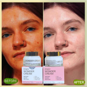 Crème Super Hydratante Éclaircissante et Anti-rides OEM O Carly à la Vitamine C et à l'Orange pour le Traitement de l'Acné et l'Éclaircissement de la Peau - Product Image 4