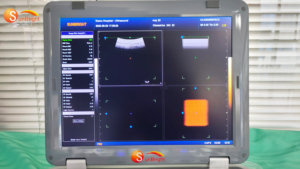 SUN-800F - Ecógrafo Portátil 3D de 15 Pulgadas con Batería Integrada, Sistema de Ultrasonido Digital para Obstetricia/Ginecología y <span class=keywords><strong>Vascular</strong></span>, para Uso en Hospitales Veterinarios - Product Image 5