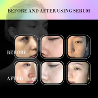 Nouveau en 2024 Machine de beauté du visage pour les salons de beauté pour améliorer les soins profonds de la peau pour la machine de beauté à domicile