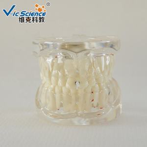 Modelo <span class=keywords><strong>Dental</strong></span> de Patología Educativa en Oferta, Modelo de Dientes Patológicos Semi-Laterales - Product Image 5