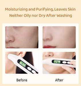 Detergente Viso Schiarente Naturale Private Label, Detergente Organico con Curcuma e Acido Cogico per Macchie Scure - Product Image 4