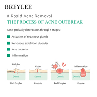 Pour BREYLEE coton bouton Patch arbre à thé colloïde hydrophile pour l'élimination de l'acné soins du visage de nuit pour les peaux grasses et sèches