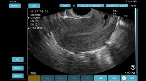 Mesin pemindai <span class=keywords><strong>Ultrasound</strong></span> Doppler warna nirkabel, pemindai vagina mikro-cembung <span class=keywords><strong>128</strong></span> elemen cembung - Product Image 6