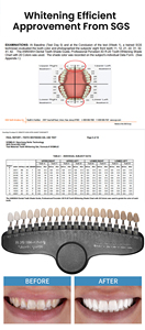 Tối đa sức mạnh răng làm trắng Gel 35% HP 44% CP Công thức chuyên nghiệp cho nhanh chóng làm trắng không Độ nhạy kết quả ở nhà - Product Image 5