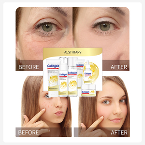 Crema Facial Antiedad con Vitamina C y Colágeno, Hidratante y Reparadora, con Péptidos para Refinar los Poros y Aclarar la Piel, Estilo Coreano - Product Image 4