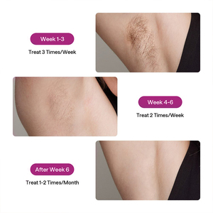 Pelo encarnado <span class=keywords><strong>para</strong></span> <span class=keywords><strong>siempre</strong></span> afeitado eliminación permanente <span class=keywords><strong>vello</strong></span> cuerpo limpio línea de Bikini zafiro hielo refrigeración IPL depilación - Product Image 5