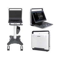 Sonoscape E2 Máquina de ultrasonido portátil 15,6 "HD Color Doppler Ultrasonido médico para clínica veterinaria humana o equipo de hospital