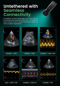 Periodmed Ultrasound Scanner Medical Handheld Handheld Portable Ultrasound Device Ultrasound <strong>Probe</strong> Wireless - Product Image 6