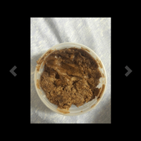 Savon Noir Africain Pâte Liquide Brut Naturel Traitement de l'Acné Contre l'Eczéma, le Psoriasis, les Cicatrices, les Taches Brunes, les Boutons et les Points Noirs