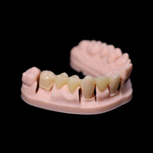 IFun น้ำยาเรซินทันตกรรม3164ความแม่นยำสูง1กก. เครื่องพิมพ์3D สีงาช้างโพลีเมอร์สวมมงกุฎชั่วคราว - Product Image 2