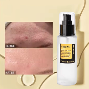 مجموعة العناية بالبشرة مضادة للشيخوخة بالكولاجين وموسين الحلزون سيروم وكريم للوجه مجموعة العناية بالبشرة بالحلزون تحتوي على هيالورونات الصوديوم - Product Image 4