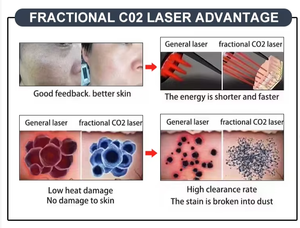เครื่องเลเซอร์ Picosecond ND Yag 3 ความยาวคลื่น 1064nm 532nm 755nm สำหรับลบรอยสักและรักษาฝ้ากระ ใช้ในคลินิก - Product Image 5