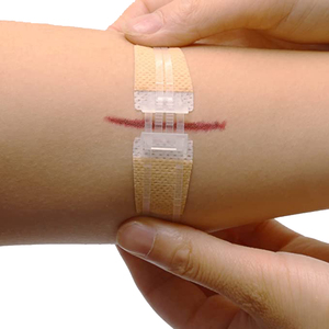 แผ่นปิดแผลแบบมีกาวในตัว สำหรับลดรอยแผลเป็น ช่วยสมานแผล ใช้ในบ้าน - Product Image 3