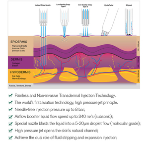 Jet d'oxygène <span class=keywords><strong>oxyjet</strong></span> jetpeel jet peel water peel machine faciale - Product Image 4
