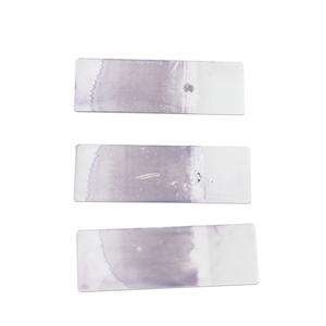 Huyết học chuẩn bị Slide máu smear cấp tính promyelocytic bệnh bạch cầu M3 APL - Product Image 3