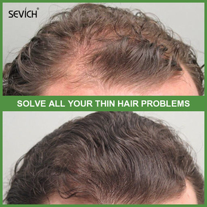 Lozione per la Crescita dei Capelli 120ML Molto Richiesta alla Fiera di Canton, Olio per la Crescita dei Capelli Tailandese per Uomini e Donne, Spray per la Crescita della Radice dei Capelli - Product Image 3