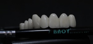 BAOT PFM céramique Incisal <span class=keywords><strong>émail</strong></span> E-1B 50g dentisterie distributeur de matériel <span class=keywords><strong>dentaire</strong></span> poudre de porcelaine laboratoire <span class=keywords><strong>dentaire</strong></span> - Product Image 5