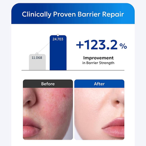 Crème hydratante anti-allergique SOS ultra réparatrice, renforce la barrière cutanée, soulage la <span class=keywords><strong>peau</strong></span> sèche, marque privée coréenne - Product Image 3