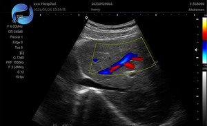 Handheld Pocket Linear Convex Phased Probe <strong>Ultrasound</strong> Scanner 3 in 1 <strong>Ultrasound</strong> Machine Doppler Portable Pocket <strong>Ultrasound</strong> - Product Image 6
