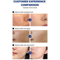 Máquina de Belleza 2 en 1 para Cuidado de la Piel y Cuero Cabelludo, Dispositivo de Hidratación Facial, Herramienta de Nutrición del Cuero Cabelludo, Uso en Casa, Salón y Spa para Rostro, Cuello y Cuero Cabelludo