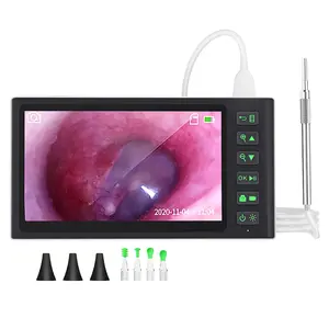 Otoscopio digitale telecamera per endoscopio HD da 7 pollici con scheda TF 32G-visualizza ed esammina orecchio naso e gola