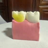 Modelo DE EDUCACIÓN anatómica para caries dental 6 demostraciones de sección transversal bilateral para estudio de ciencia médica
