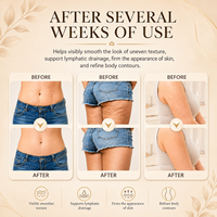 Meilleure Vente : Appareil de Massage Électrique Anti-Cellulite et Amincissant pour le Corps Entier, Thérapie par Ventouses et Aspiration Sous Vide, Type Guasha
