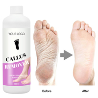 Liquide exfoliant pour les pieds 500 ml, éliminateur de callosités, adoucissant pour les pieds et les cuticules des ongles