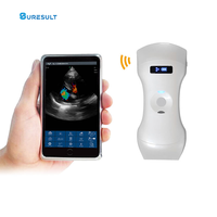 Échographie portable efficace D3 Pro 3 en 1 avec sondes convexes 3.5/5 MHz et sondes phasées 2.5/5 MHz pour centres de physiothérapie