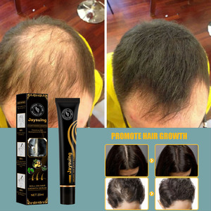 OEM Boule de poils Solution de soins de massage hydratante Anti-chute de cheveux Stimulation de la naissance des cheveux Traitements de la repousse des cheveux - Product Image 1