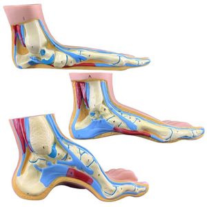 Pied plat de pied normal <span class=keywords><strong>humain</strong></span> et modèle de pathologie d'anatomie du pied arqué 3PCS - Product Image 3