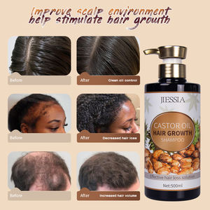 แชมพูผมร่วงจากขิงแท้แชมพูปลูกผมธรรมชาติไบโอตินรักษาผมได้อย่างรวดเร็ว - Product Image 4