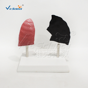Modèle anatomique médical pour le tabagisme Modèle d'<span class=keywords><strong>anatomie</strong></span> humaine médicale Modèle de comparaison du <span class=keywords><strong>poumon</strong></span> fumeur de <span class=keywords><strong>poumon</strong></span> humain - Product Image 2