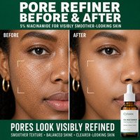 Serum Niacinamide Alami untuk Mencerahkan, Memutihkan, dan Menghilangkan Noda pada Kulit
