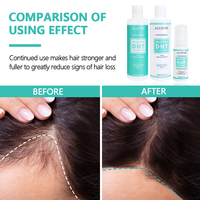 Shampoo anti-chute de cheveux biologique naturel à la biotine et au DHT, vente en gros, prévention de la perte de cheveux, shampooing bloqueur de DHT, marque privée