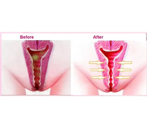 Gran oferta de 100% perlas Yoni naturales de hierbas naturales <span class=keywords><strong>tampones</strong></span> de desintoxicación extraídos de hierbas para mujeres perlas de desintoxicación de Punto Limpio Vaginal - Product Image 5